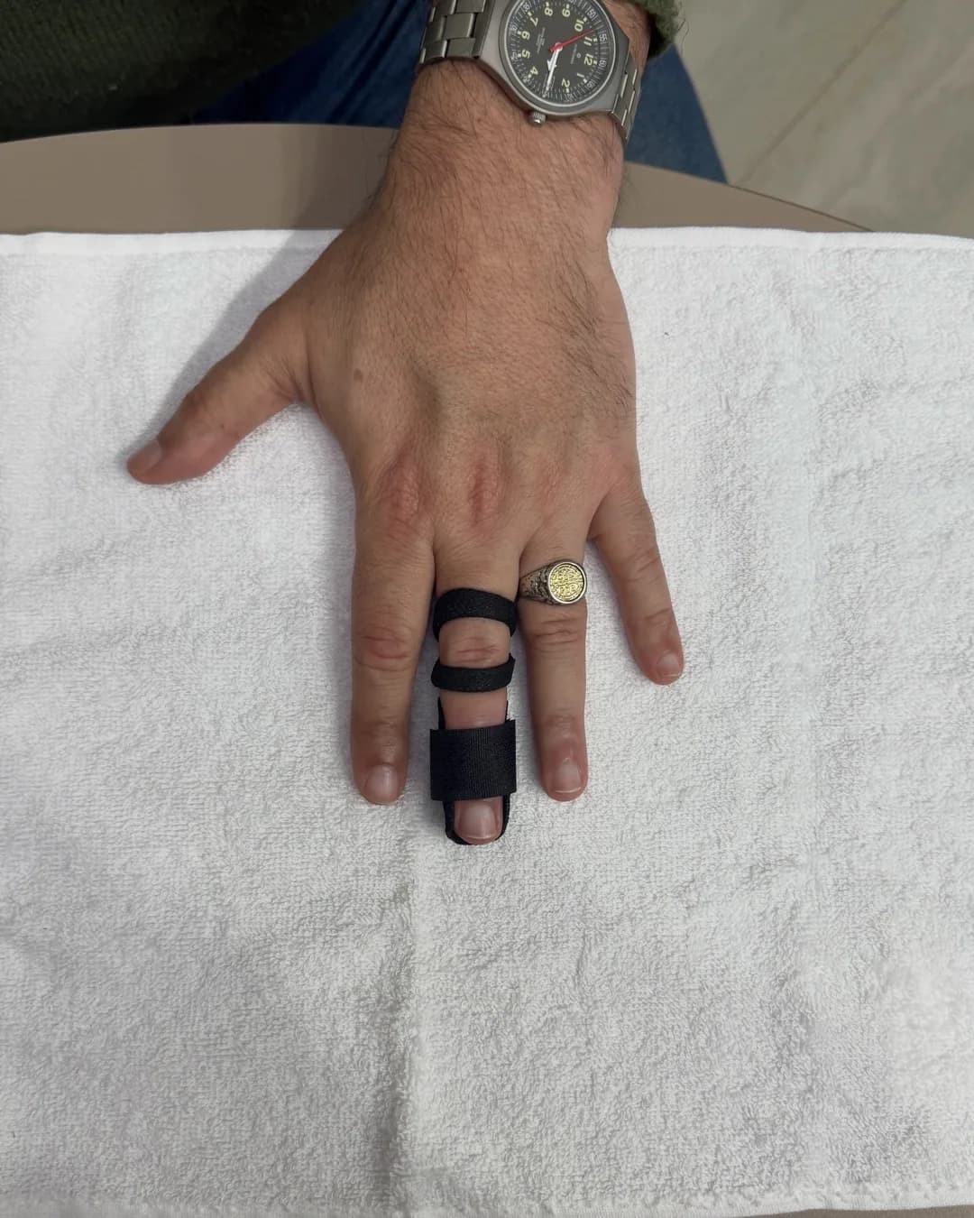 Férula de dedo en martillo confeccionada con Orficast